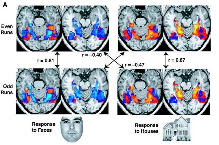 Neuromarketing - nöro pazarlama nedir?